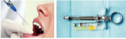 胰島素，牙科麻醉6.png